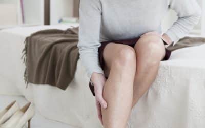 What you need to know about Varicose Veins