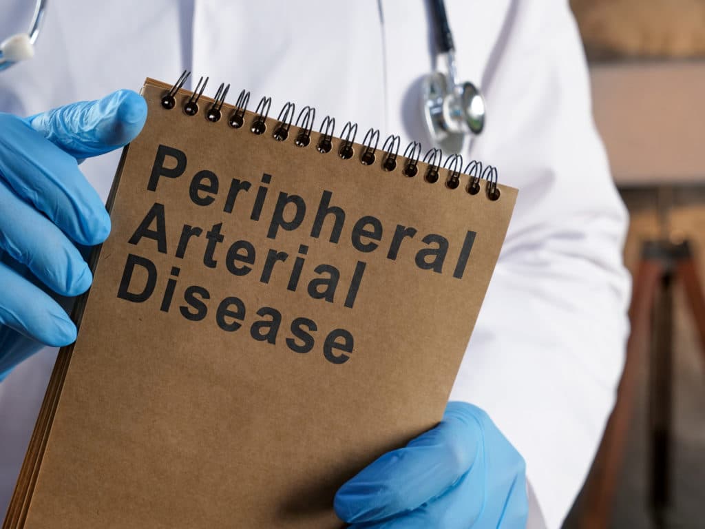 Peripheral arterial disease Doctor