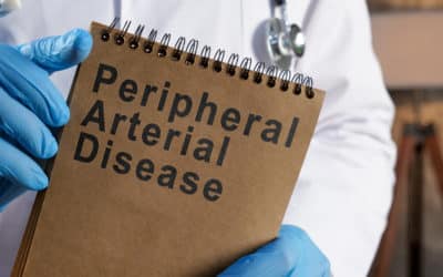 7 Facts About Arterial Disease