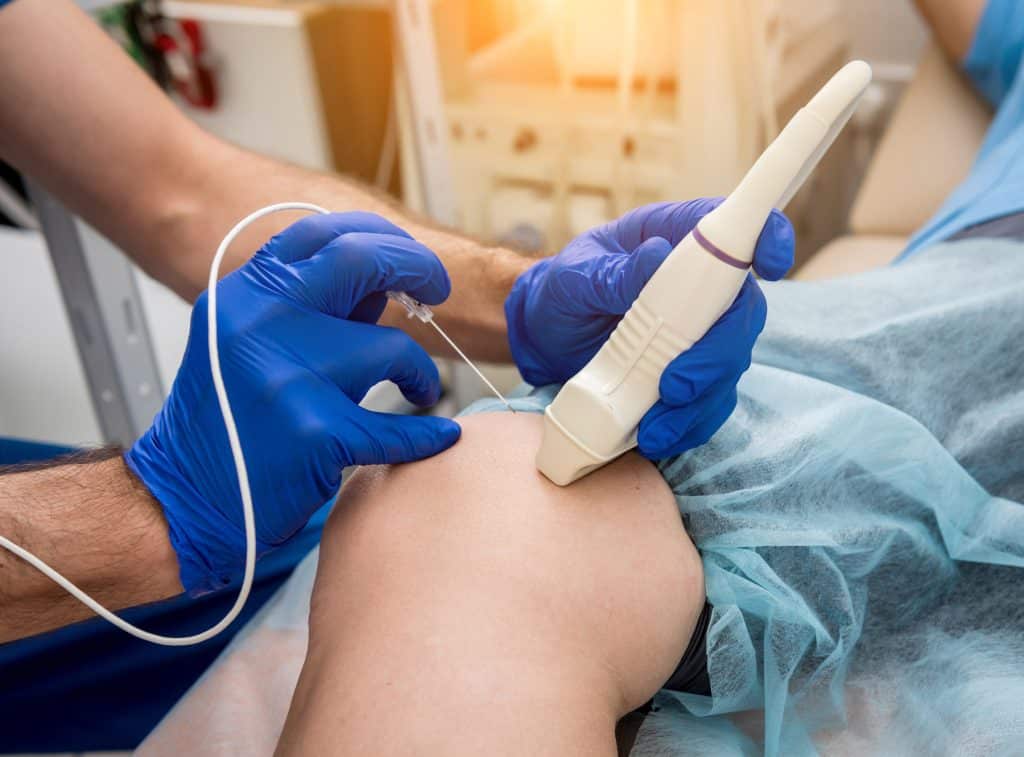 Radiofrequency Ablation Helps Eliminate Varicose Veins