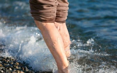 What Is The Difference Between Varicose Veins And Spider Veins?