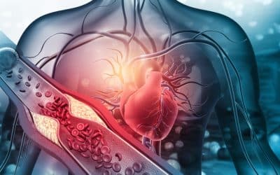 Understanding Atherosclerosis and Thrombosis Differences