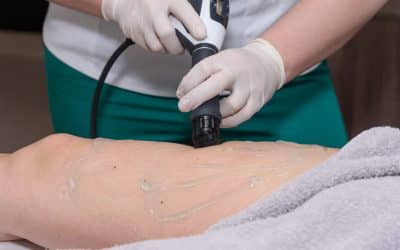 Understanding and Treating Post-Inflammatory Hyperpigmentation on Legs