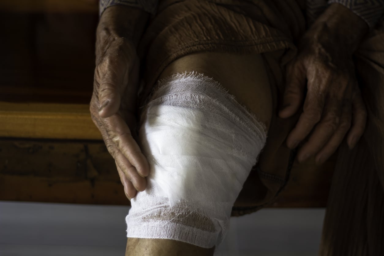 Compression Therapy
