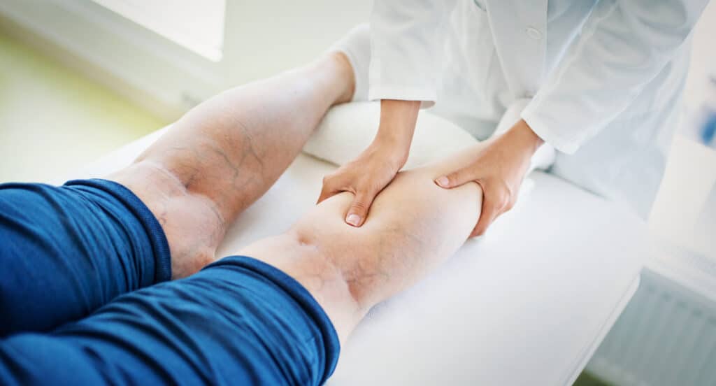 Critical Limb Ischemia