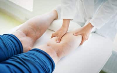 Preventing Critical Limb Ischemia: Key Strategies