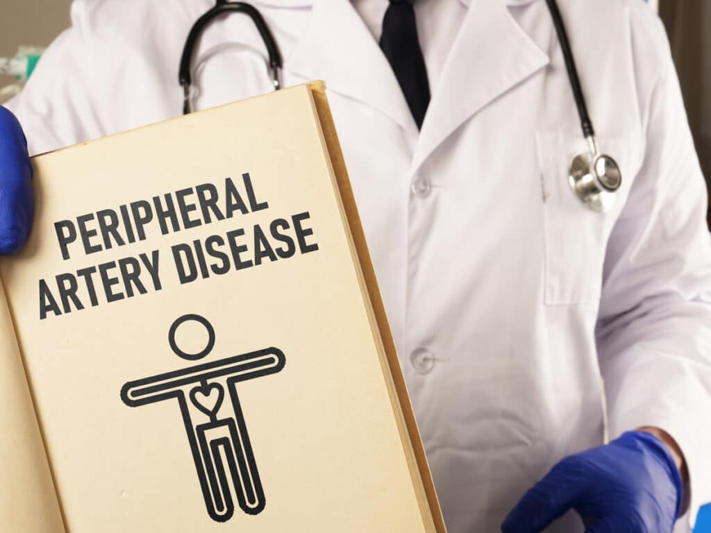 Peripheral Artery Disease